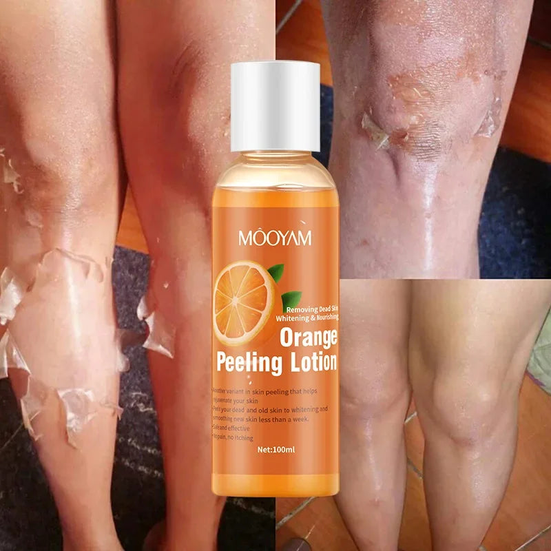 Orange Peeling Lotion Peeling Oil Body Lotion